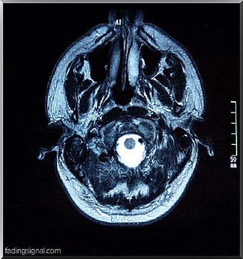 Ways to balance brain chemistry without drugs