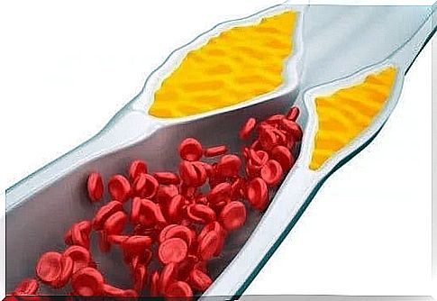 Habits that raise blood cholesterol