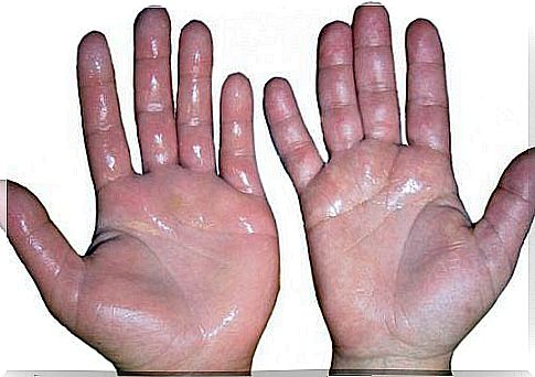 6 natural remedies for swollen hands