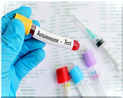 Symptoms of high levels of immunity to cortisol