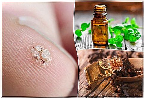 7 essential oils that help remove warts