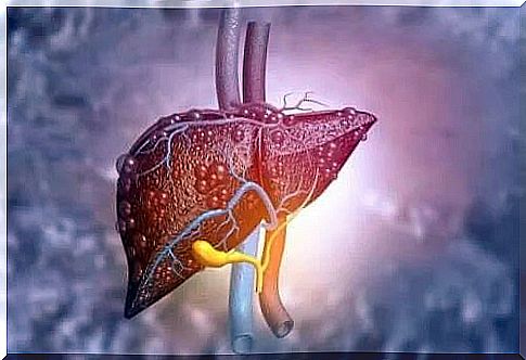 Liver affected by liver disease