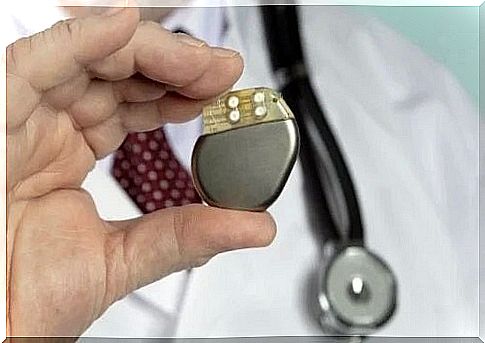 Doctor holding a pacemaker