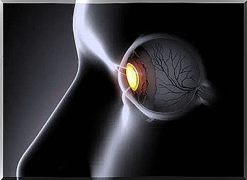 Symptoms and treatments for crossed eyes