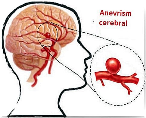 Detection of aneurysms and their prevention