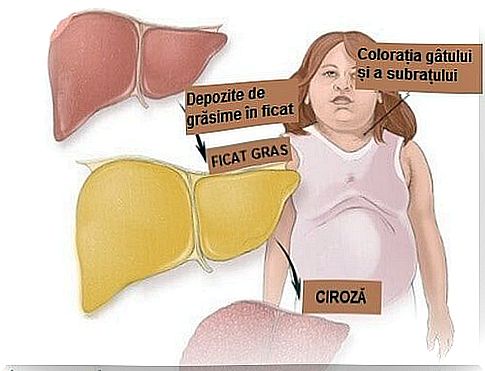 Fatty liver - causes and symptoms