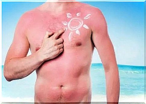 Harmful effects of the sun on the skin