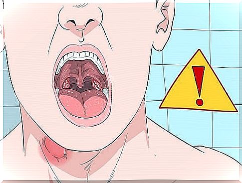 Nodules on the vocal cords - 5 possible signs