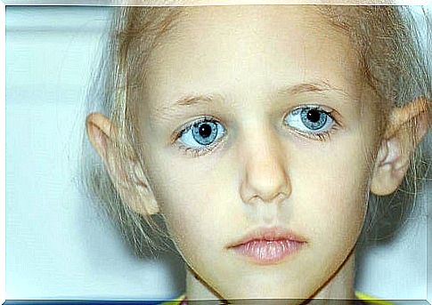 Child with retinoblastoma symptoms