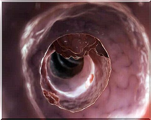 The inside of a colon